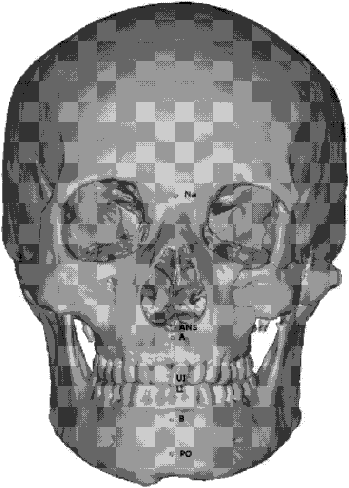cn107374728a_颅颌面畸形应用骨性标志点建立标准正中矢状面的方法在